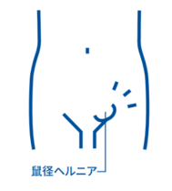 soke4.png