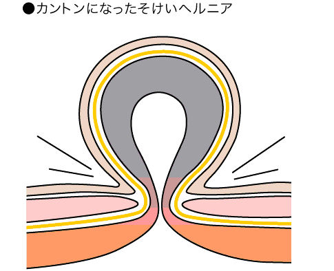 soke3.png